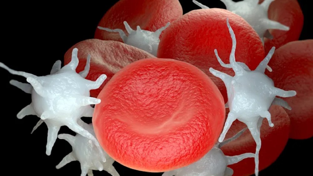 嚴重血小板增多症 (ET)