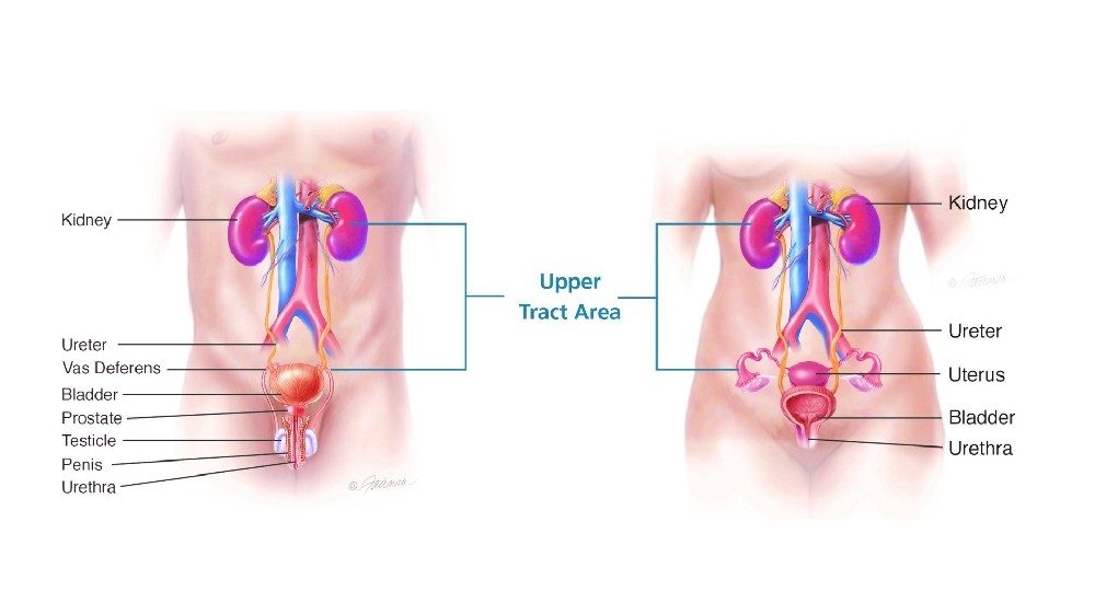 輸尿管 腎盂癌 上尿路 尿路上皮癌